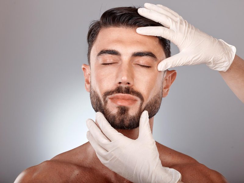 Buccal Fat Surgery Result